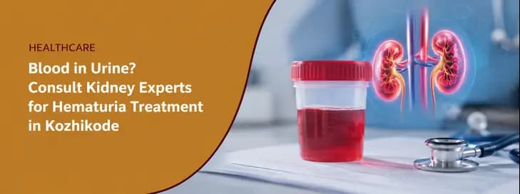 Hematuria Treatment in Kozhikode 1