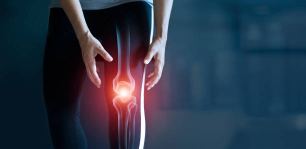 Arthritis - An Overview