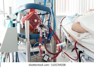 Extracorporeal Membrane Oxygenation (ECMO)