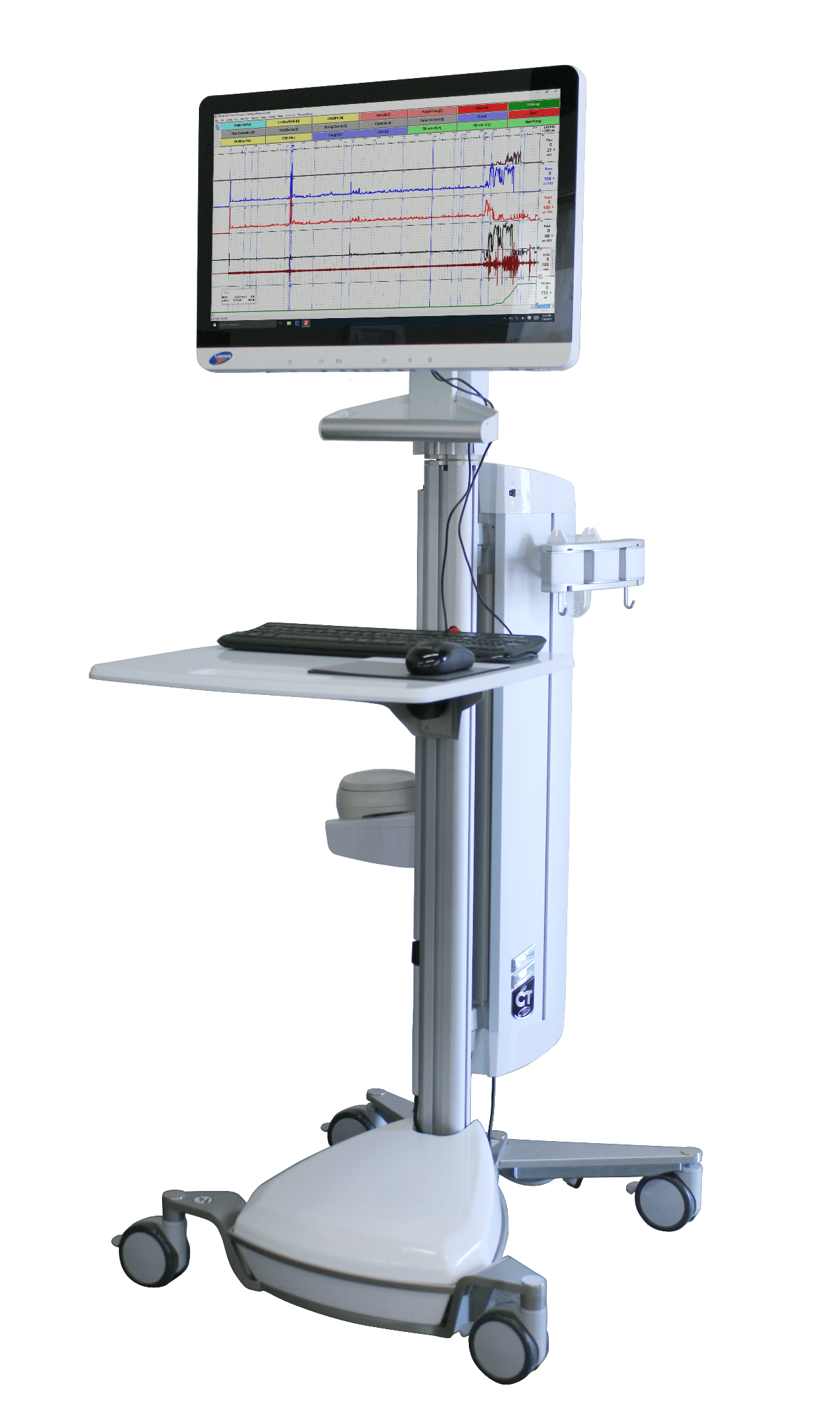 Multichannel Urodynamics