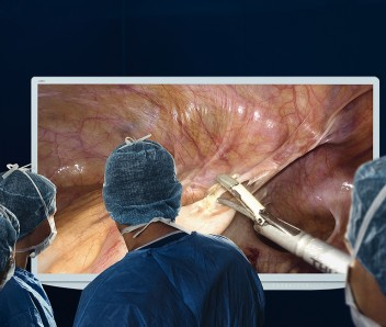 4K Laparoscopy System