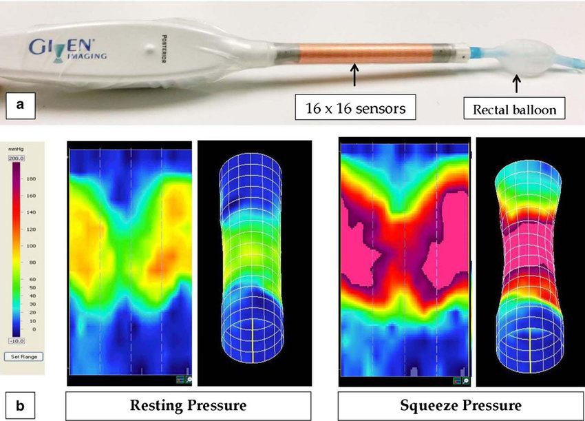 24 channel Water-Perfused High-Res Oesophageal and Anorectal Manometry